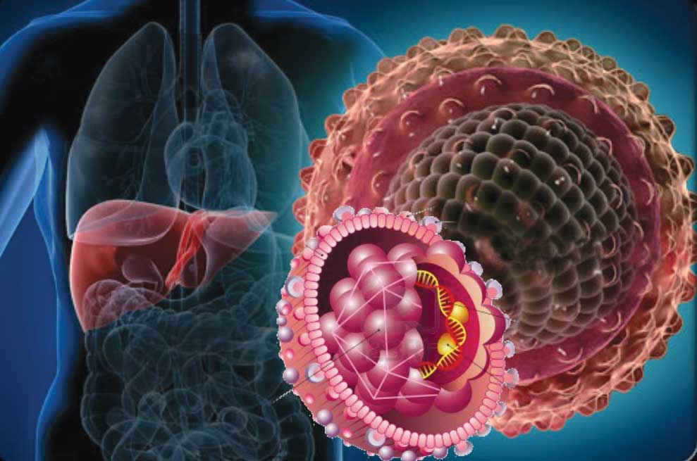 Вирусный гепатит С Вирусный гепатит С